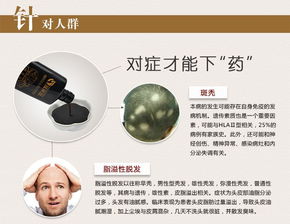 肾气充足不仅能保持身体健康,更能养发润发